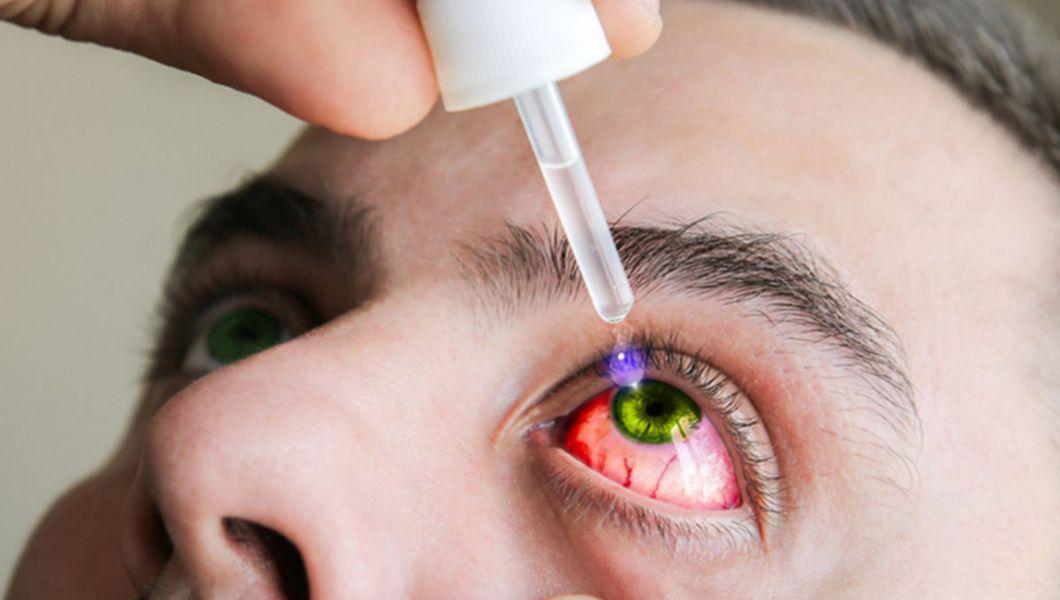 tratament pentru lovituri la ochi