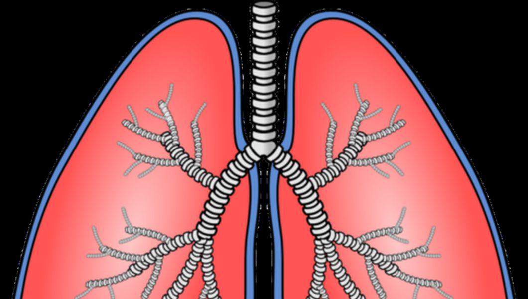 radiografie la plamani - remedii pentru ifnectii respiratorii