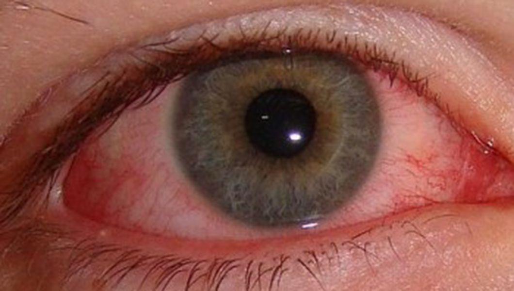 Principalele afectiuni ale ochiului | g23.ro