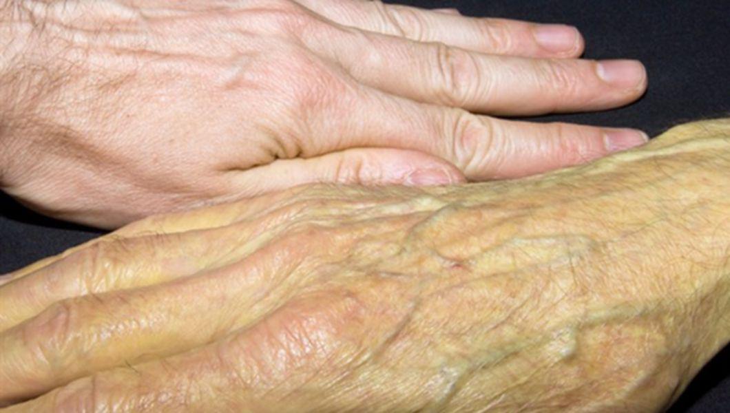 maini afectate de bilirubina directa crescuta