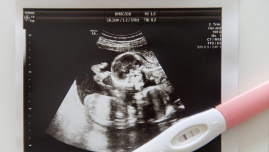 poza de ecografie a bebelusului si un test de sarcina