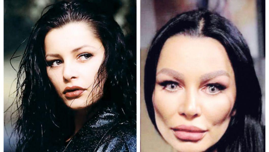 Brigitte Pastramă înainte și după operațiile estetice