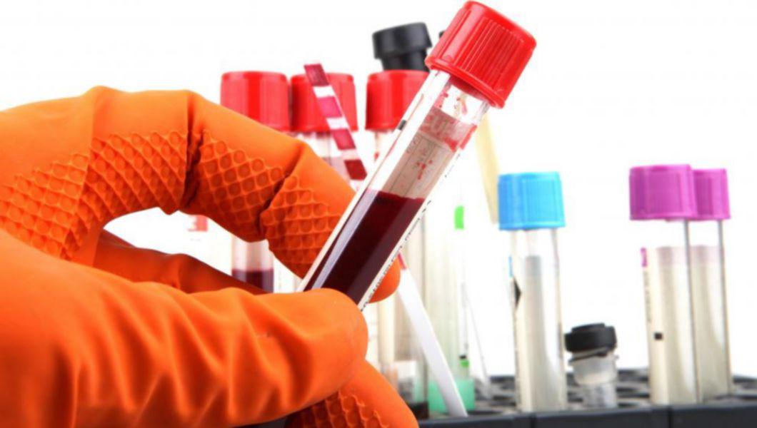 Testul de sânge care ar putea depista cancerul înainte de orice simptom ...
