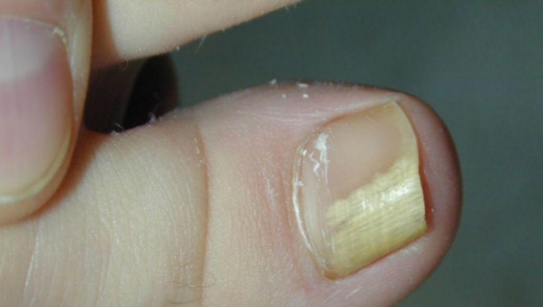 Cum să elimini murdăria de sub unghii acasă. Cum să curățați mâinile și unghiile după grădinărit