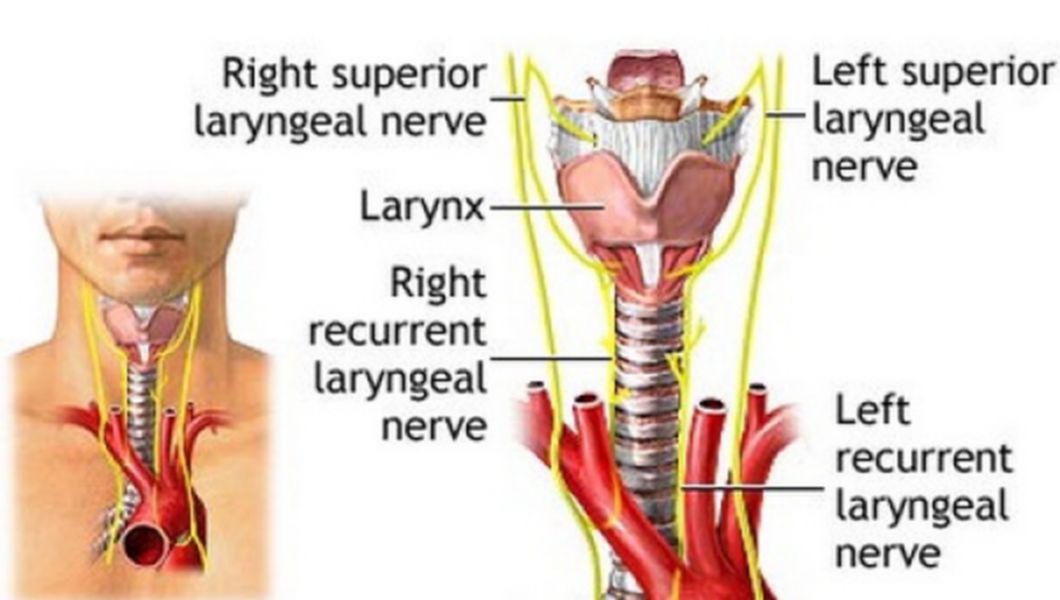 Cancerul Laringian Simptome Si Tratament Buna Ziua Iasi Bzi Ro