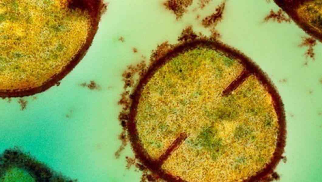 Infectiile Cu Stafilococ Simptome Si Tratament Buna Ziua Iasi Bzi Ro