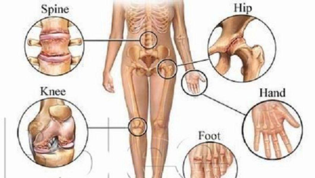 Cum Se Prepara Spirtul De Oase Leac Pentru Reumatism Artroza Sciatica Gonartroza Dureri Musculare Si Osoase Buna Ziua Iasi Bzi Ro