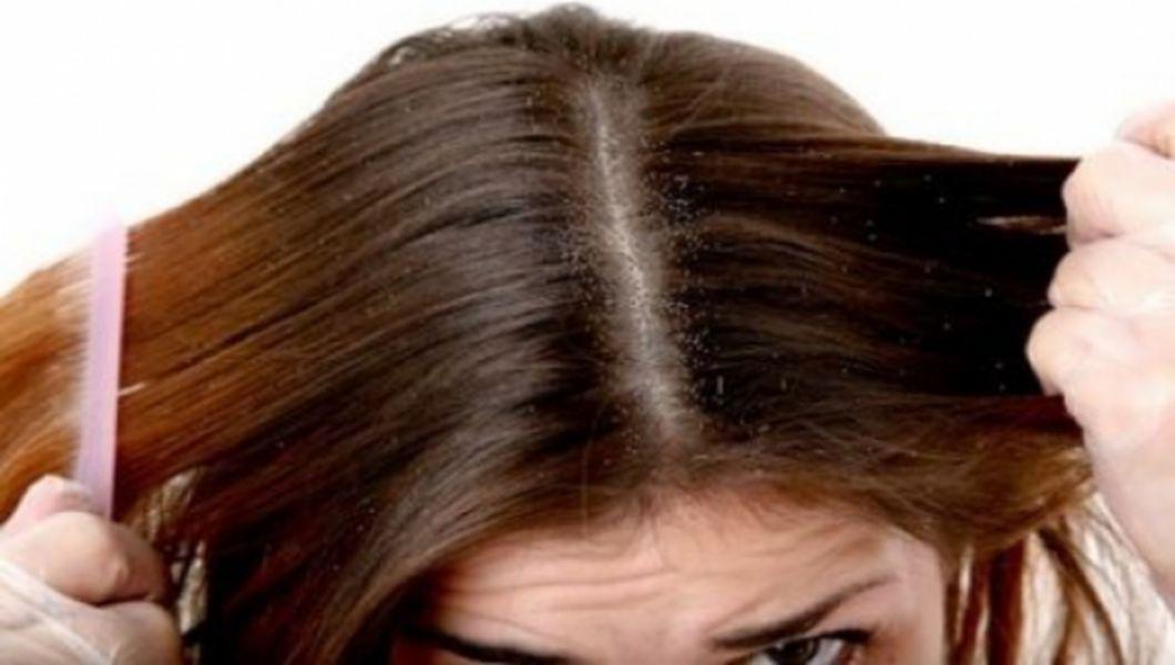Cele Mai Bune Solutii Anti Matreata Bzi Ro