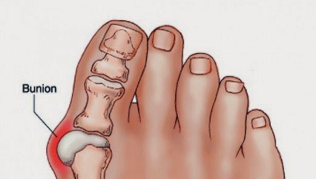 inflamația articulațiilor unguentului degetelor