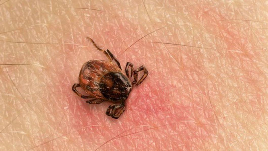 Medicii Ne Avertizeaza Atentie La Intepaturile De Capuse Bzi Ro