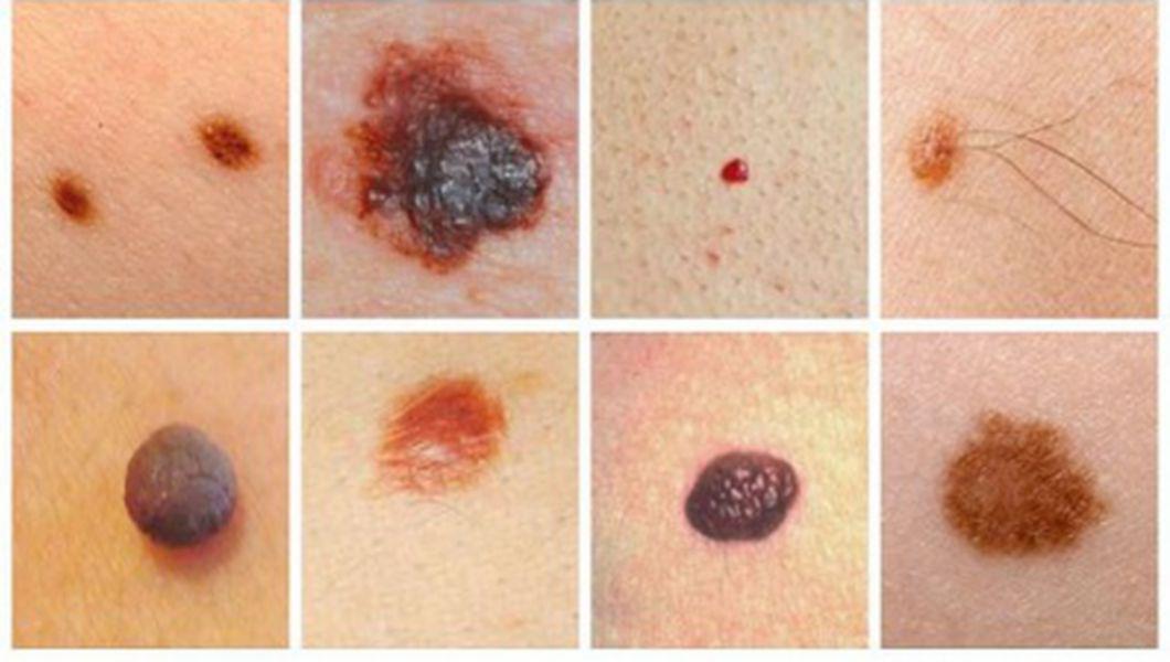 Cum Putem Identifica Acasa Alunitele Cu Potential Cancerigen Bzi Ro