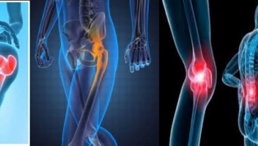 artroza interfalangiană a tratamentului piciorului