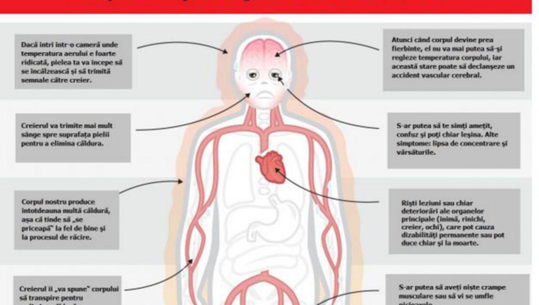 De Ce Ne Este Cald Atunci Cand Temperatura Aerului E Aceeasi Cu Cea A Corpului Nostru Buna Ziua Iasi Bzi Ro