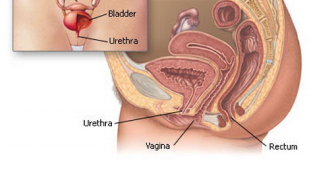 remedii naturiste pentru infectia urinara cuidados despues de biopsia transrectal de prostata