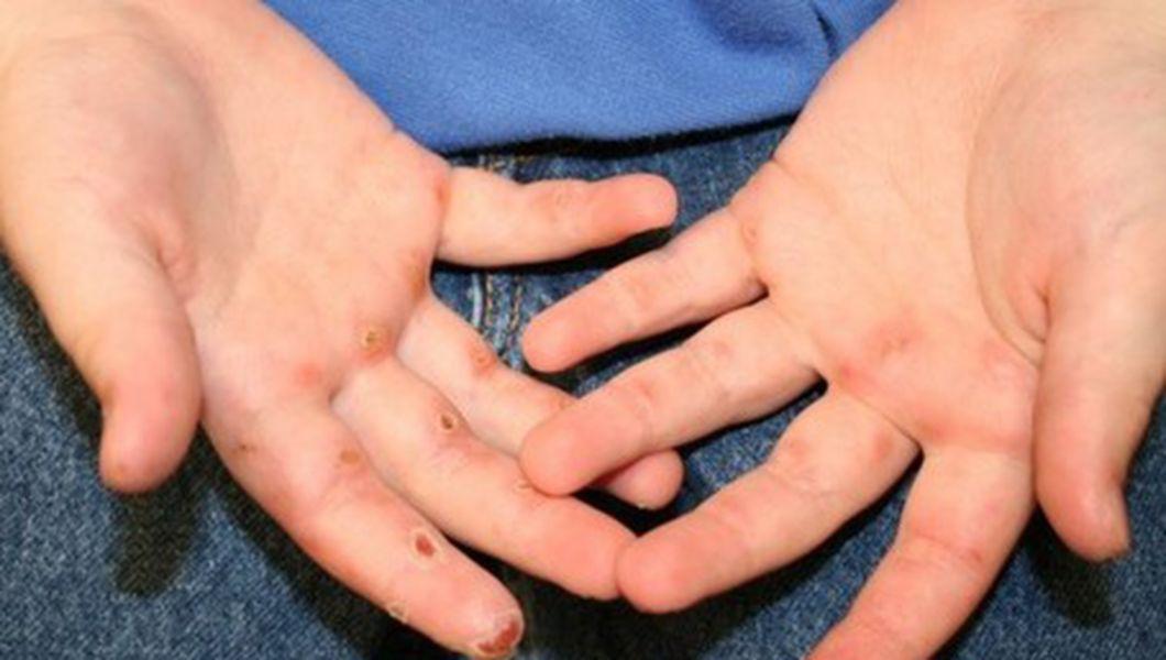 10 Metode Care Te Ajuta Sa Inversezi O Boala Autoimuna Buna Ziua Iasi Bzi Ro