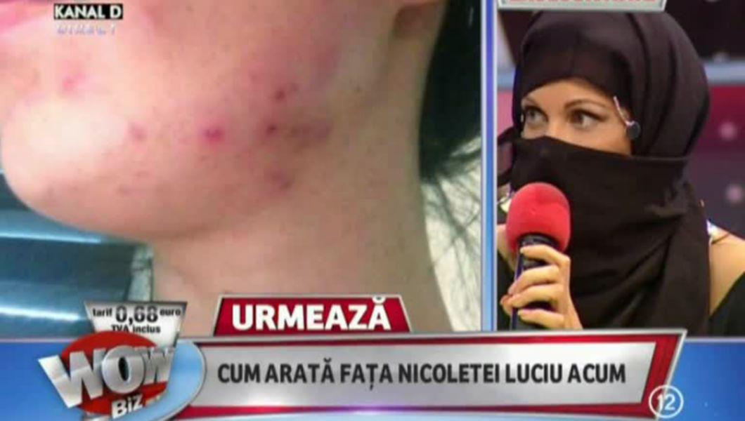 Nicoleta Luciu Distrusa De Stafilococul Auriu Bzi Ro