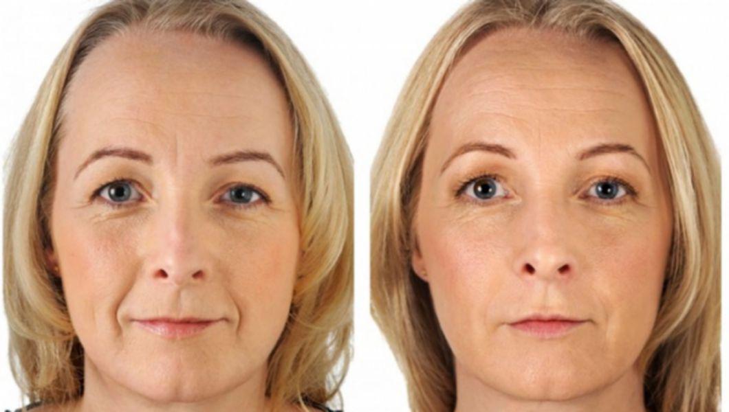 îngrijire anti-îmbătrânire pentru pielea sensibilă