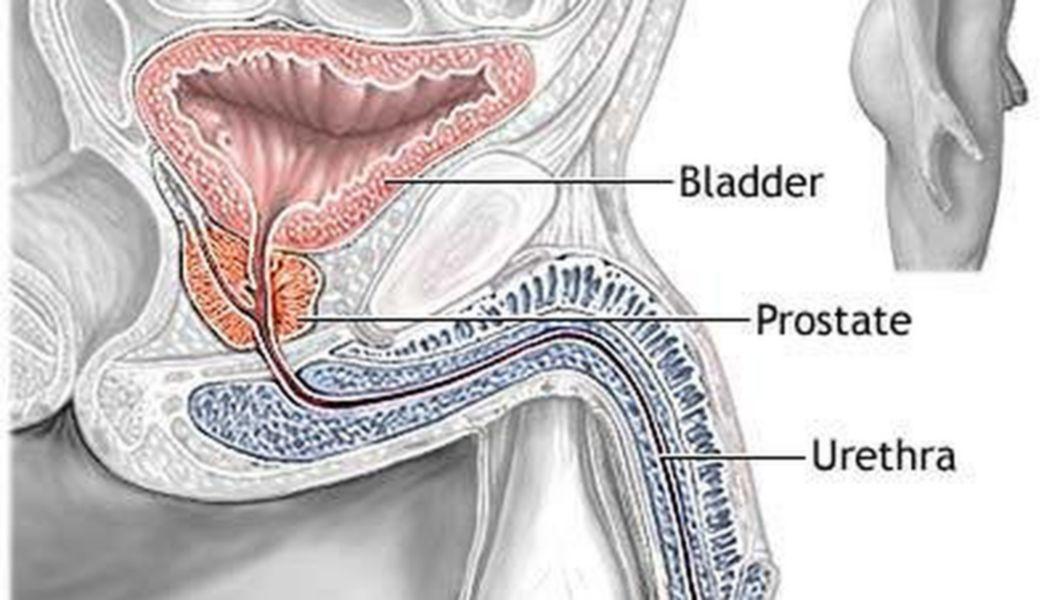 Prostatita: cauze, simptome, tratament