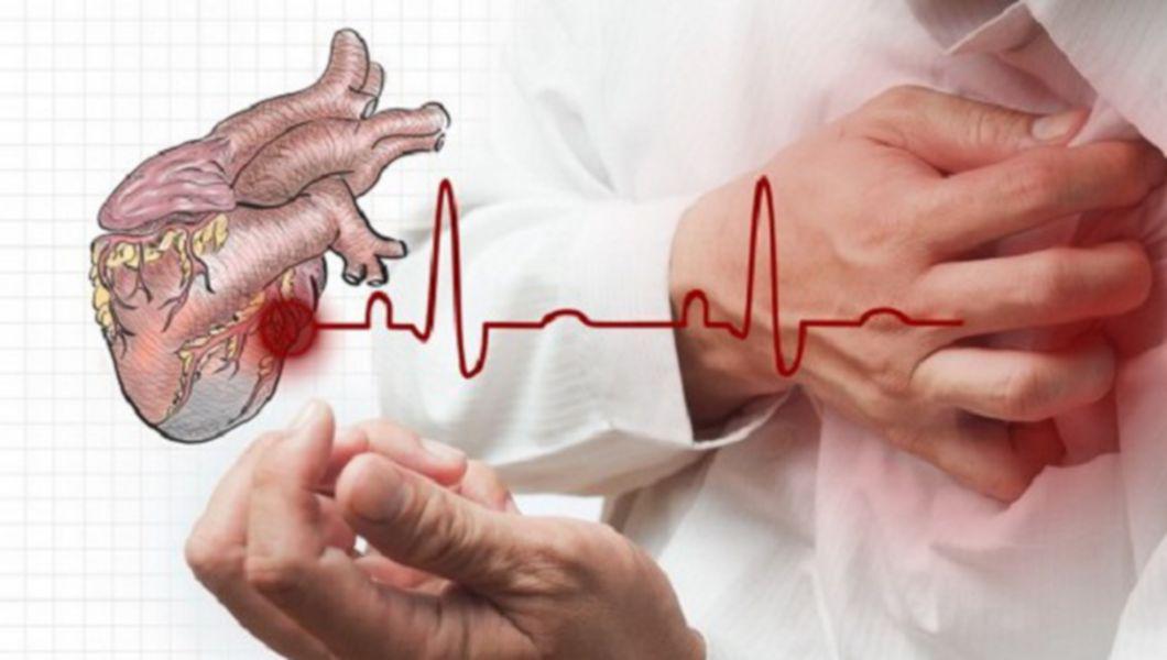 Cum recunosc infarctul de miocard?