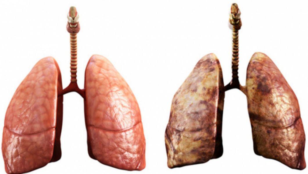 detoxifierea plamanilor la fumatori