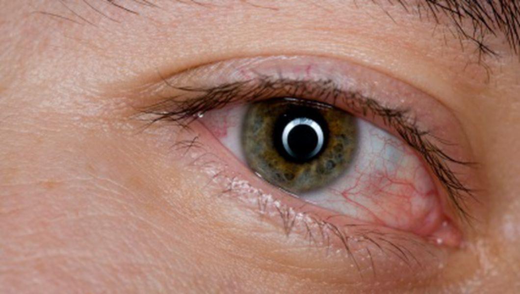 Transmiterea genetica a bolilor oftalmologice « Dr. Monica Pop