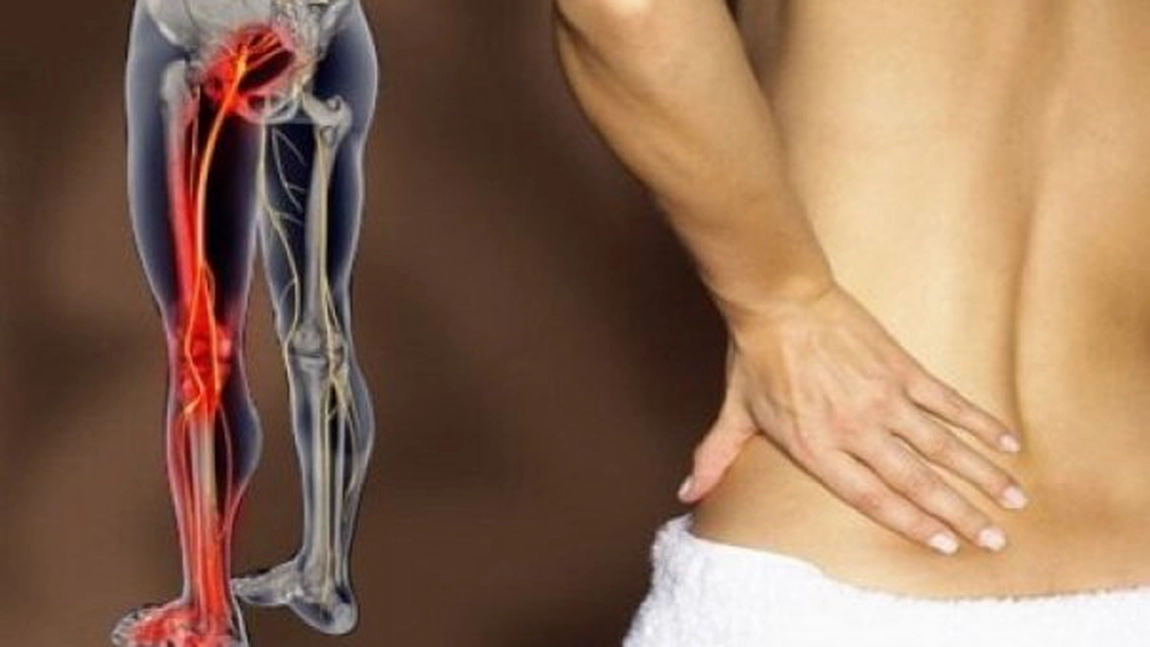 Spuneti la revedere durerii de sciatica! Imbunatatiri in doar 10 minute cu aceasta metoda naturala!