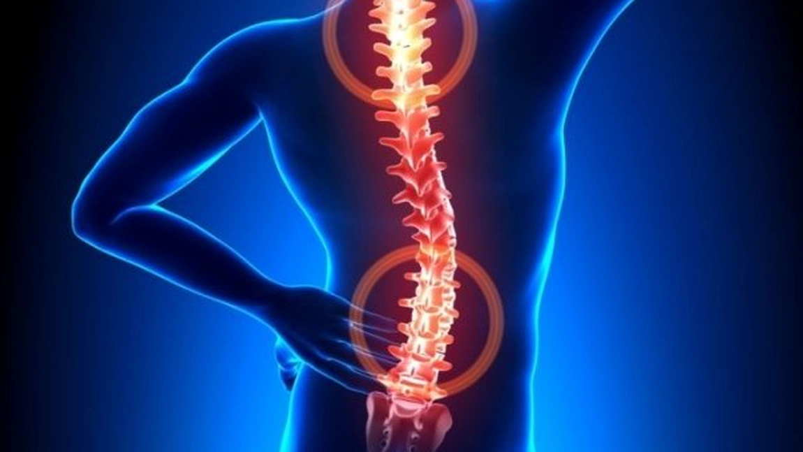 Medic: Exista pacienti care la 20-30 de ani se imbolnavesc de spondilita, iar la 50 fac infarct
