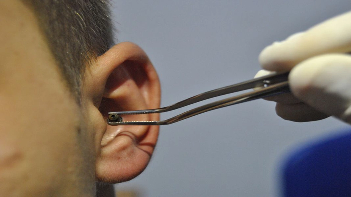INFIORATOR! Trei tineri ieseni au ajuns la spital dupa ce au copiat la un examen! Castile magnetice s-au blocat in ureche! Medicii spun ca se poate ajunge la operatie