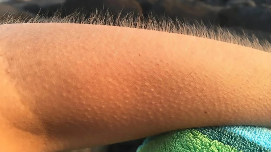 Piele de gaina: de ce ti se ridica parul pe mana cand asculti muzica si ce spune asta despre creierul tau