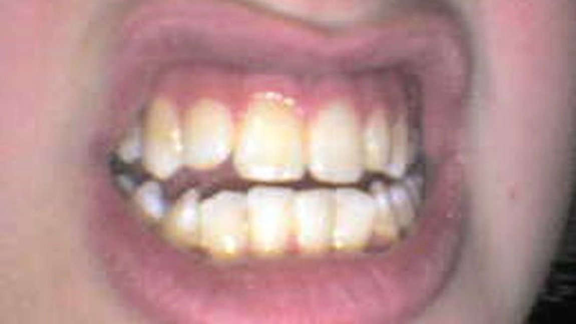 Un barbat gol a atacat o femeie, incercand sa ii MANANCE capul!
