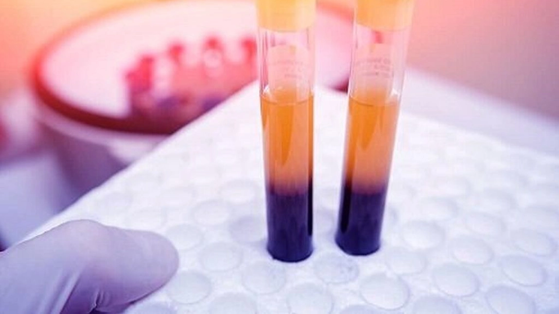 4 remedii ce ajuta la cresterea numarului de trombocite