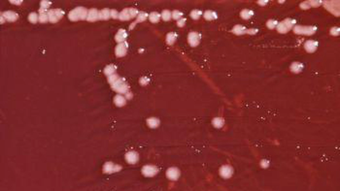 Pseudomonas, bacteria care ucide