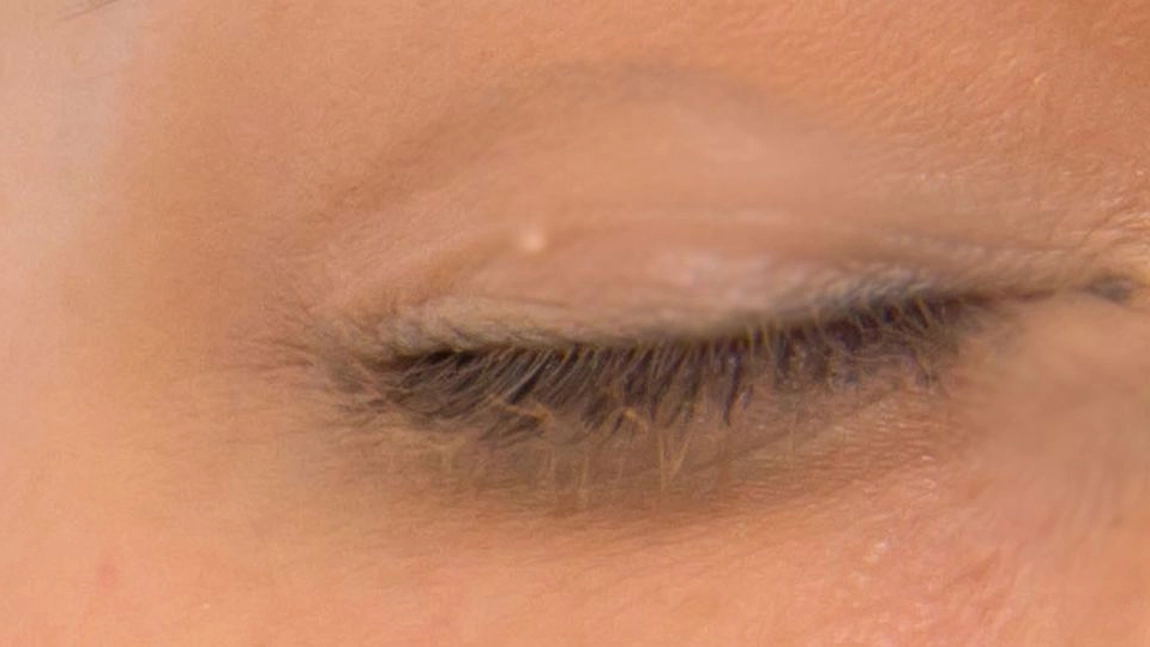 Daca ai aceste semne pe fata, nu le indeparta acasa! Ce sunt, de fapt