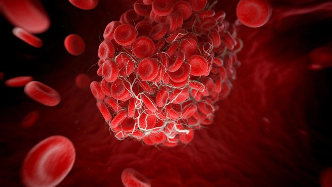 Alimente care previn cheagurile de sange. Consuma-le frecvent si reduci riscul unei boli mortale