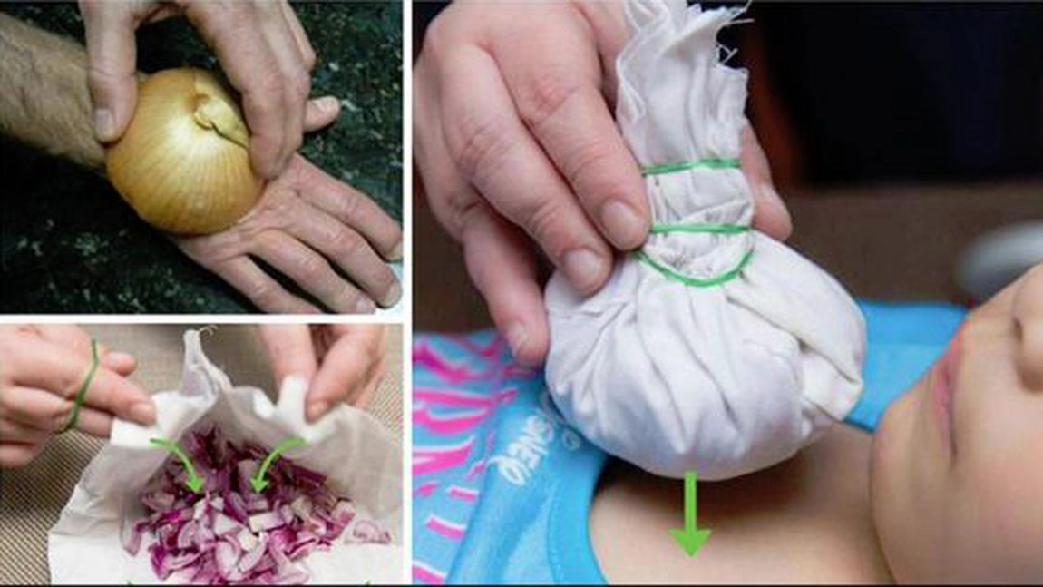 Ceapa este un excelent remediu pentru multe afecțiuni