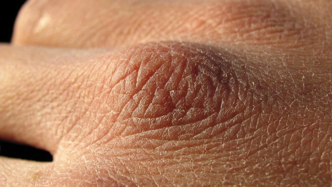 Cum se schimbă culoarea pielii atunci când tiroida, inima şi plămânii nu funcționează corect