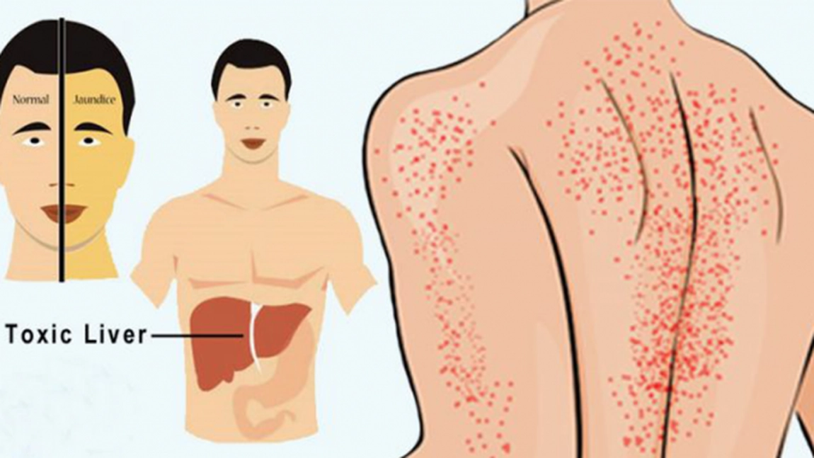 Tu îl consumi zilnic! Iată alimentul care îți distruge ficatul mai tare decât alcoolul