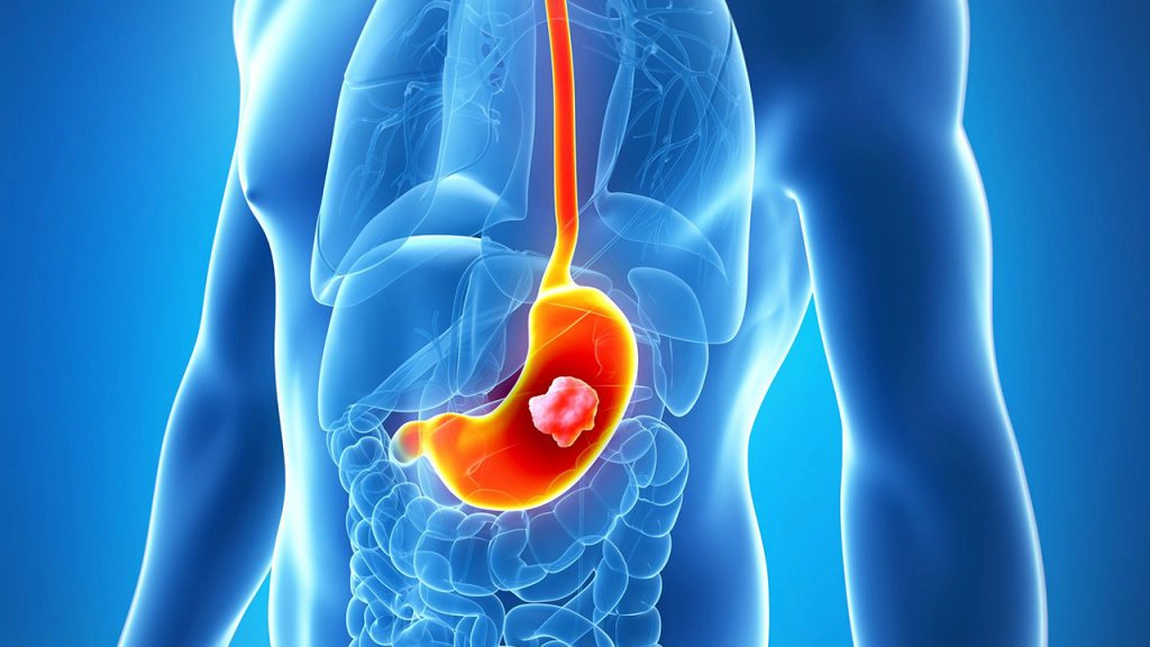 Două-cinci ore de activitate fizică pe săptămână reduce riscul pentru șapte cancere