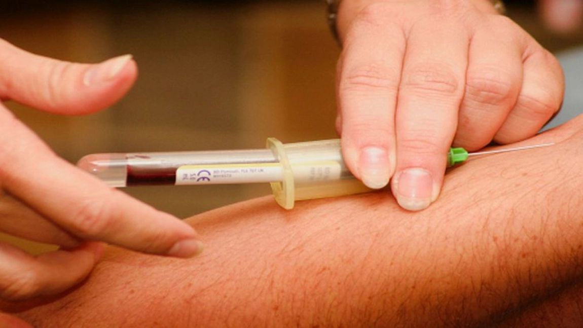 Vârful epidemiei de hepatita C va fi atins în 2020! Medicii sunt în alertă și insistă să vă testați! Boala poate fi fatală