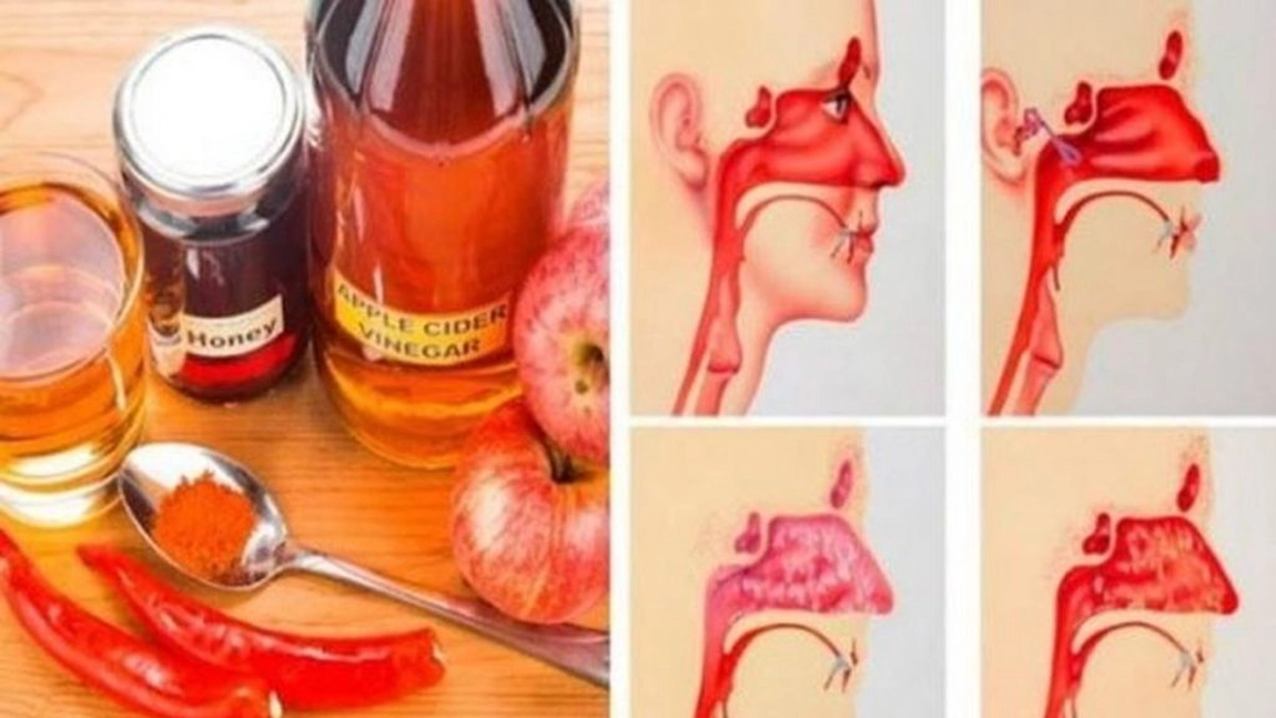 Scapă de infecţiile sinusurilor cu această metodă