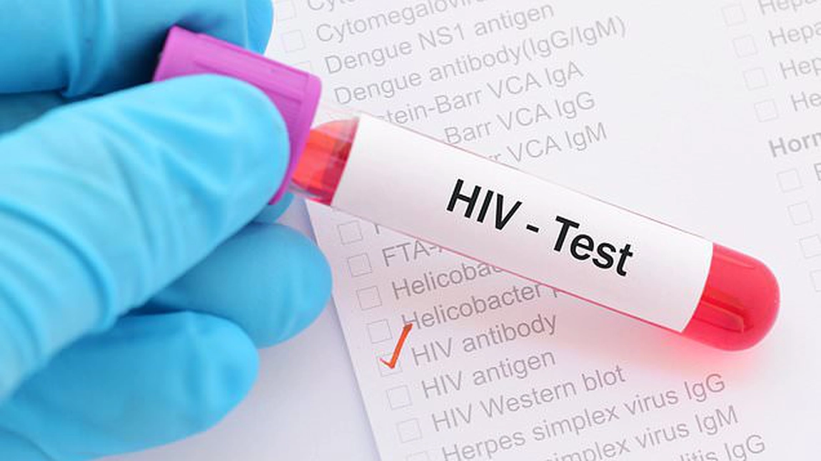 Au fost oprite testele pentru vaccinul anti-HIV. Sunt considerate un eşec: 
