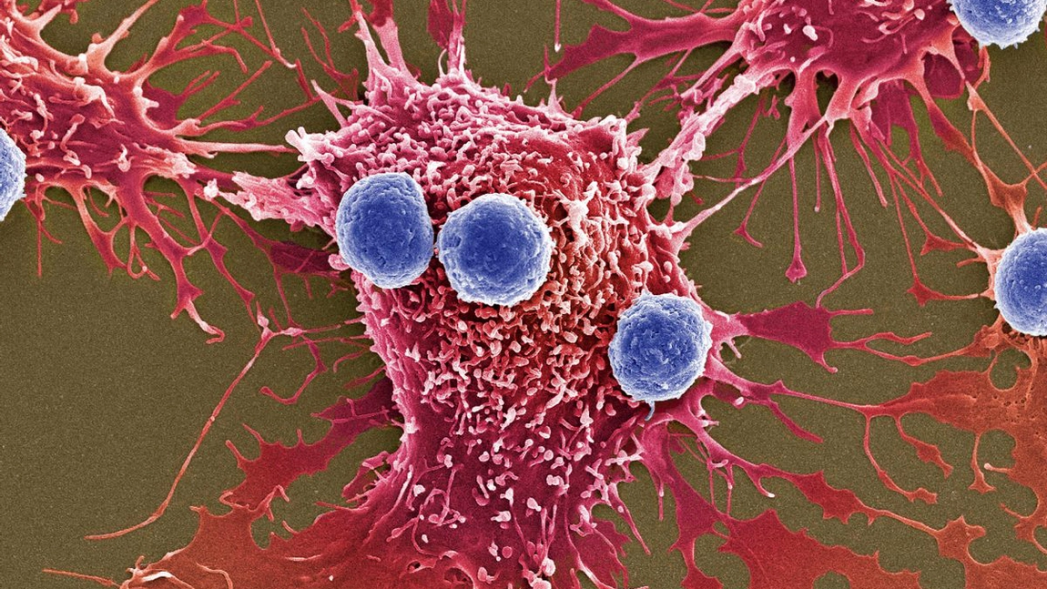 Peste 50 de tipuri de cancer pot fi depistate cu ajutorul unui simplu test de sânge