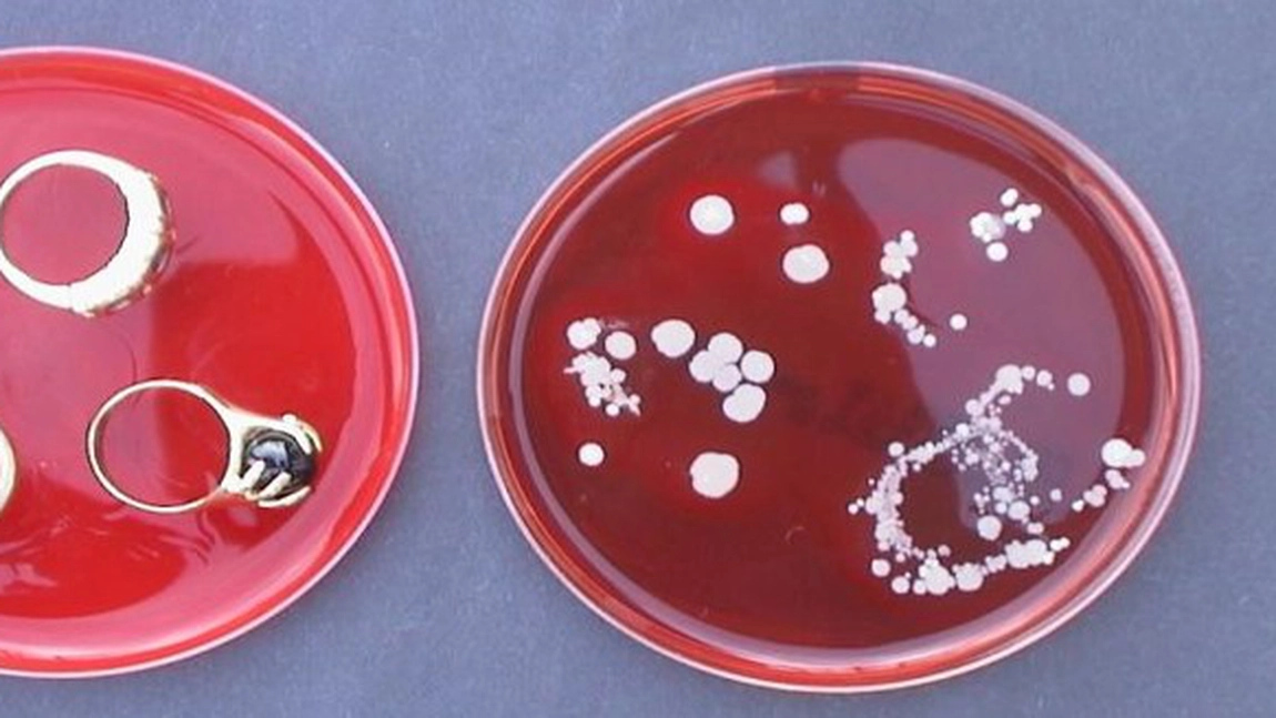 Coronavirus: De ce nu e bine să porţi bijuterii şi ceasuri pe mâini - Sfaturi de care pot depinde vieţile oamenilor