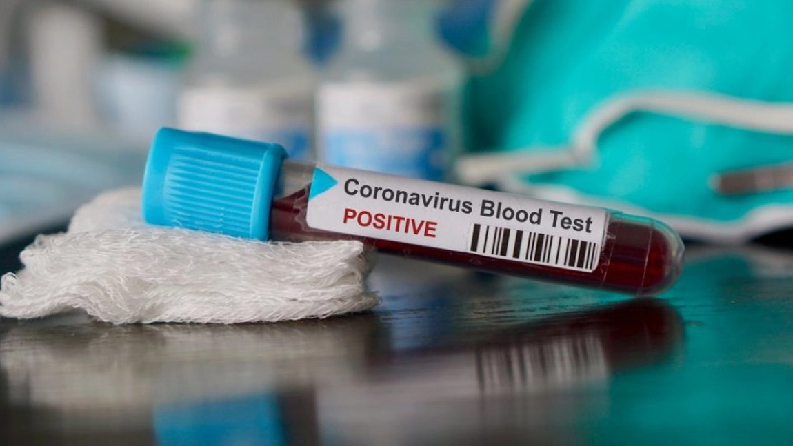 Direcția de Sănătate Publică Iași a făcut anunțul! Peste 720 de persoane sunt izolate la domiciliu