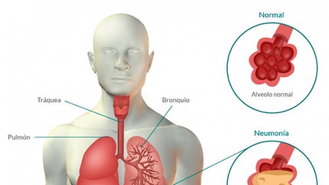 Siropul cu care te protejezi de bolile respiratorii