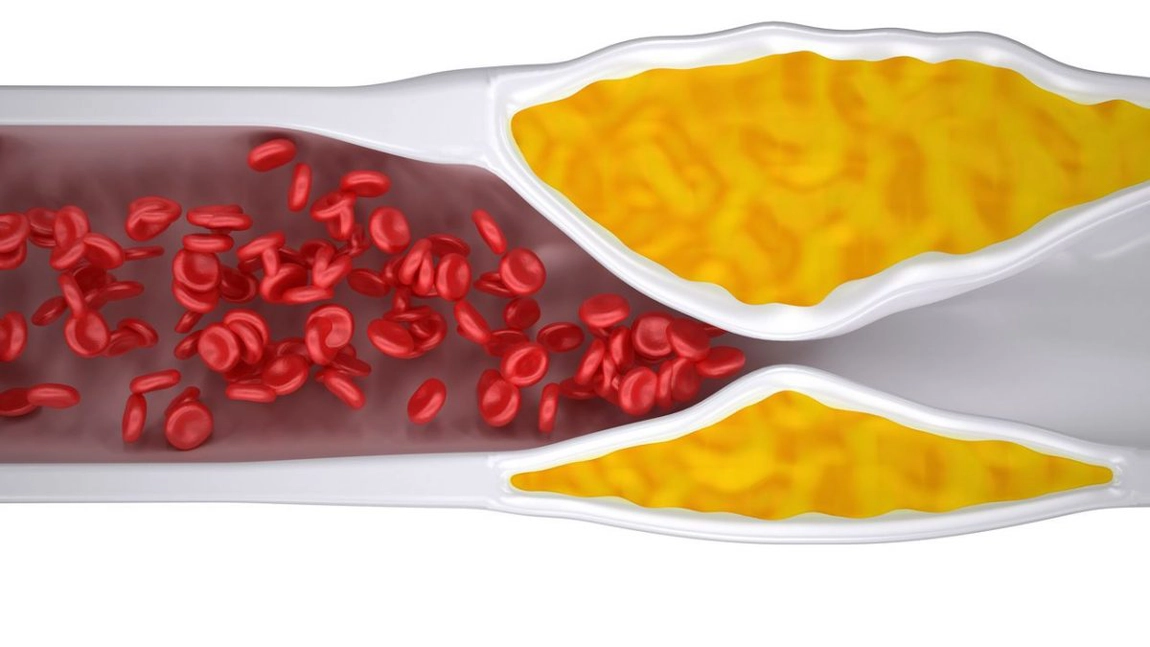 9 alimente din bucătărie care ajută la desfundarea arterelor