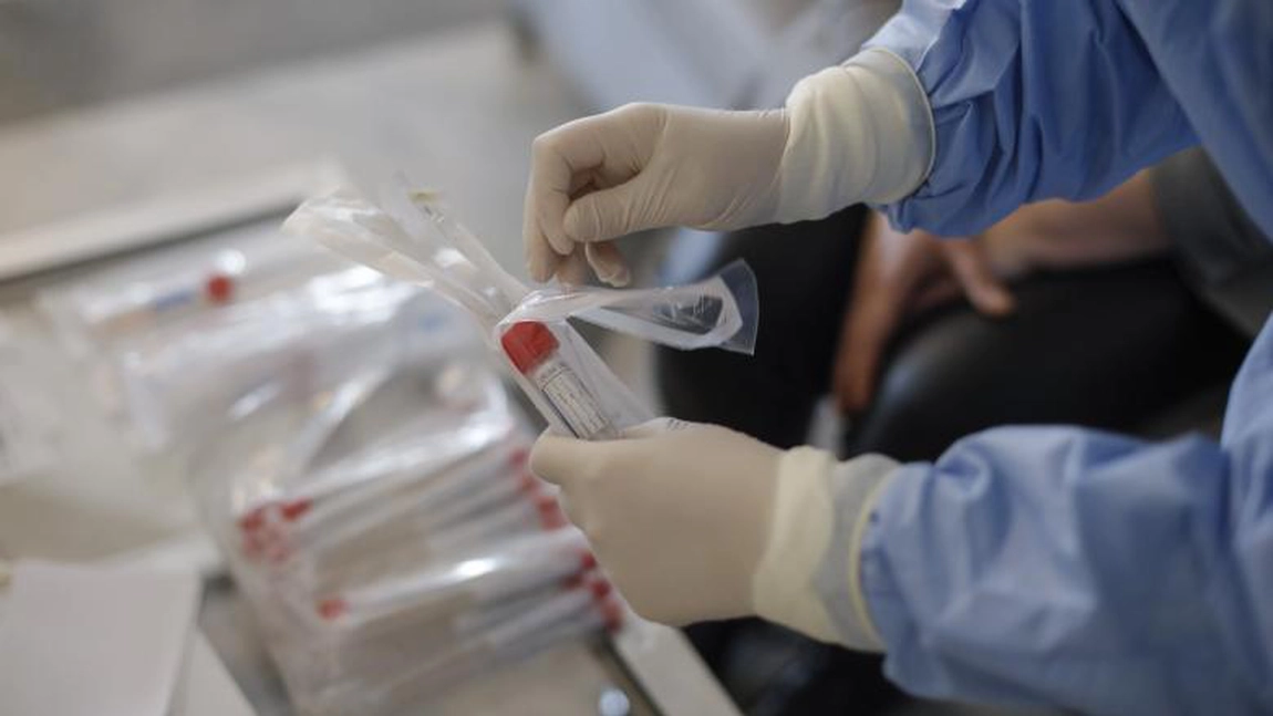 Atenţie! Au apărut noi simptome la persoanele infectate cu COVID-19