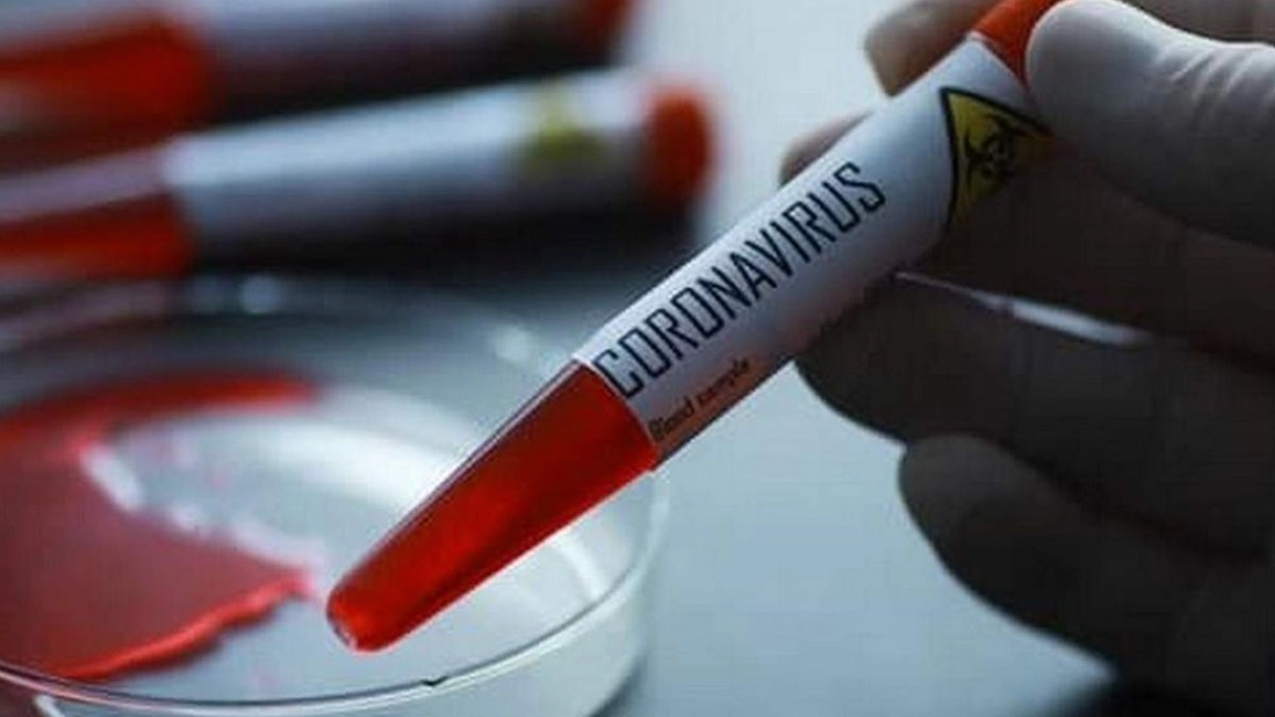 Val de decese înregistrat în România, din cauza Covid-19. Bilanțul a ajuns la 387