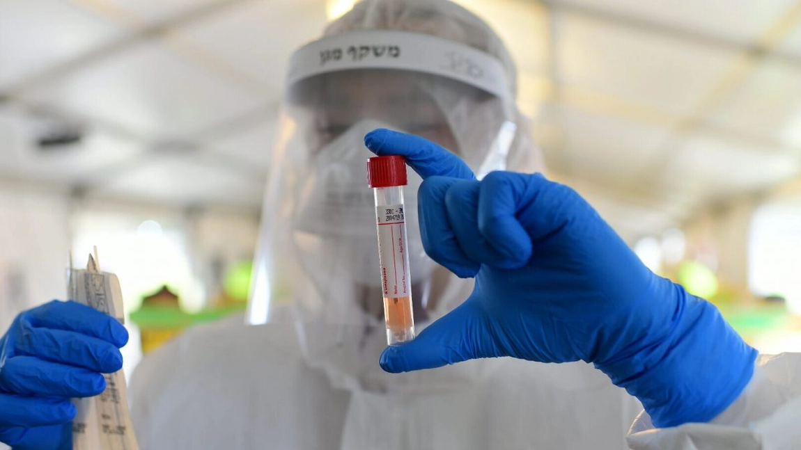 România înregistrează alte 10 decese cauzate de SARS-CoV-2. Bilanțul a ajuns la 790