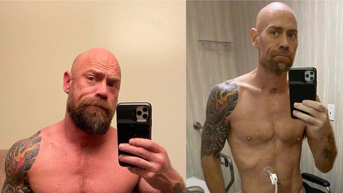 Cât de mult s-a schimbat un bolnav de Covid-19 în 8 săptămâni de spitalizare